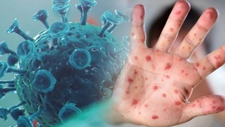 Beyoğlu'nda Maymun çiçeği paniği: Şüpheli test negatif